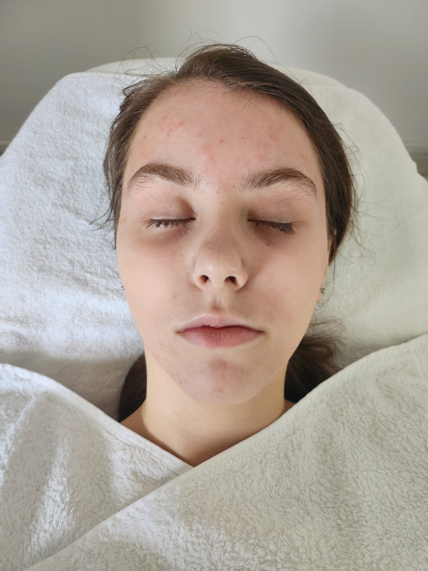 Kundin liegt entspannt mit geschlossenen Augen auf der Behandlungsliege, bereit für die Hautbildanalyse